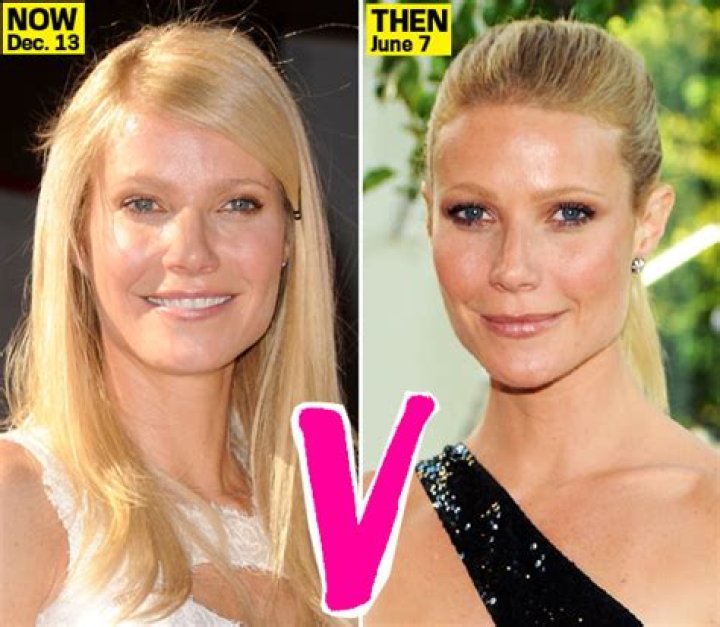 Fillers, Botox & Laser Treatments Gave Gwyneth Paltrow Her Puffy New Face! – Hollywood Life